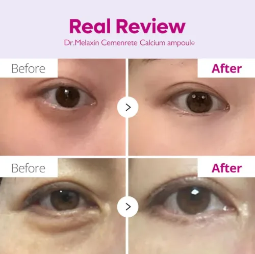 Dr.Melaxin Cemenrete Calcium Volume Ampoule Plus Je Serum Posebno Formulisan Za Zatezanje Koze 2