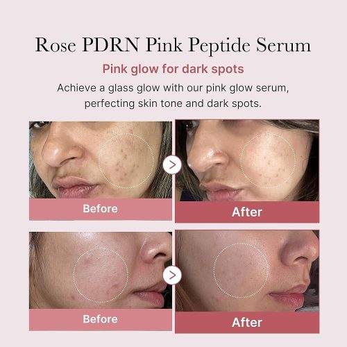 Medicube PDRN Pink One Day Serum