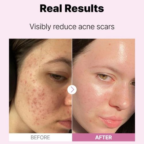 Cosrx The Niacinamide 15 Serum