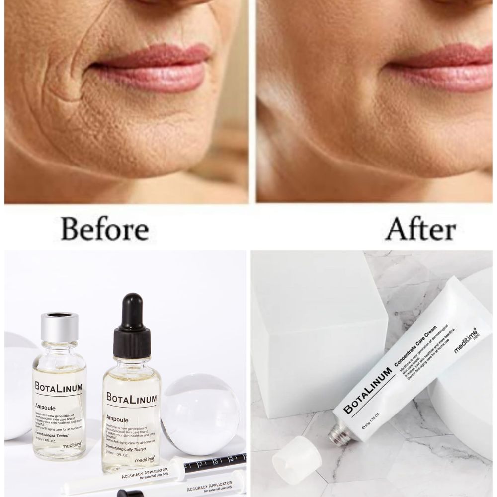 Meditime Botalinum Ampoule