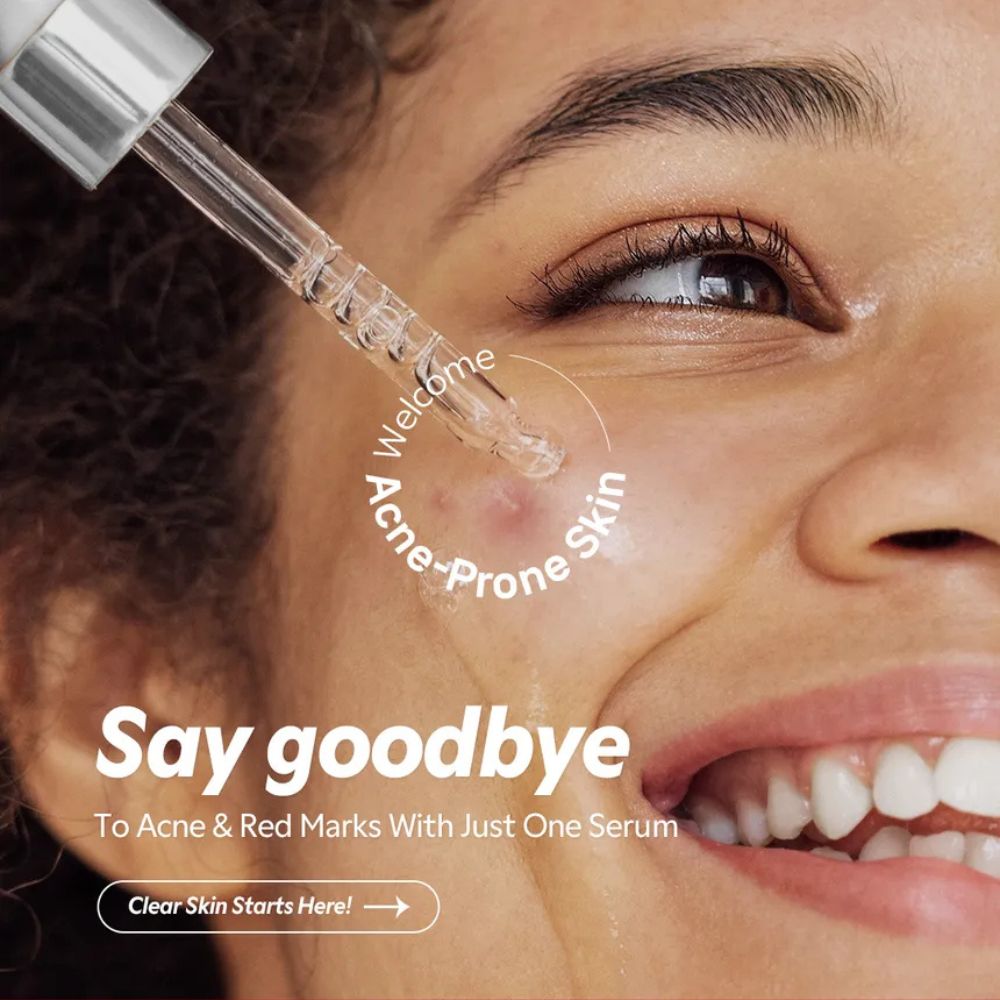 TIRTIR Azelaic Acid 12% Serum