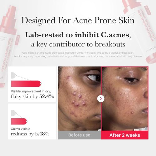 Medicube Hypochlorous Acid Daily Facial Spray