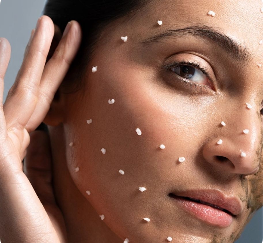 Mikroiglice u kozmetici