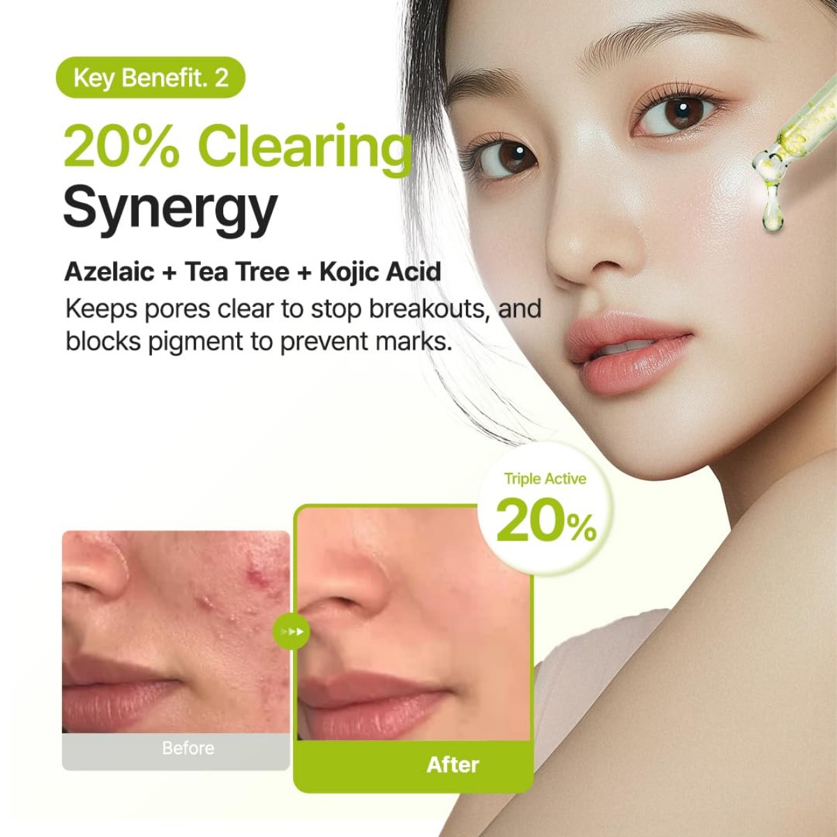 Purito Azelaic Acid 10 Kojic Tea Tree Serum 1